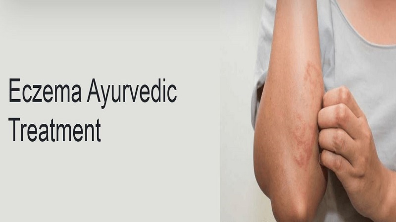 Eczema Ayurvedic Treatment