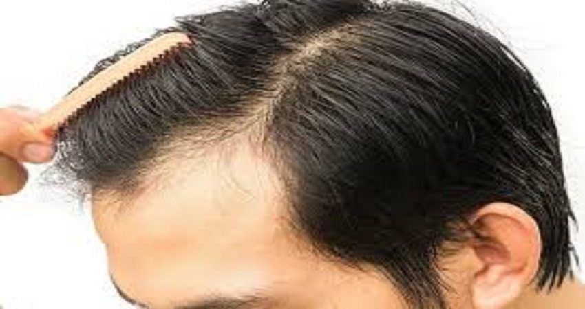 How to Find Best Hair Transplant Doctor in Jaipur?