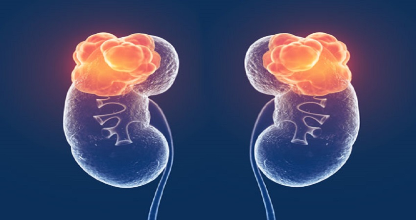 Urology cancer doctor in Jaipur