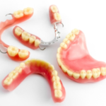 The Benefits of Retainer Treatment With a Dental Clinic in San Antonio